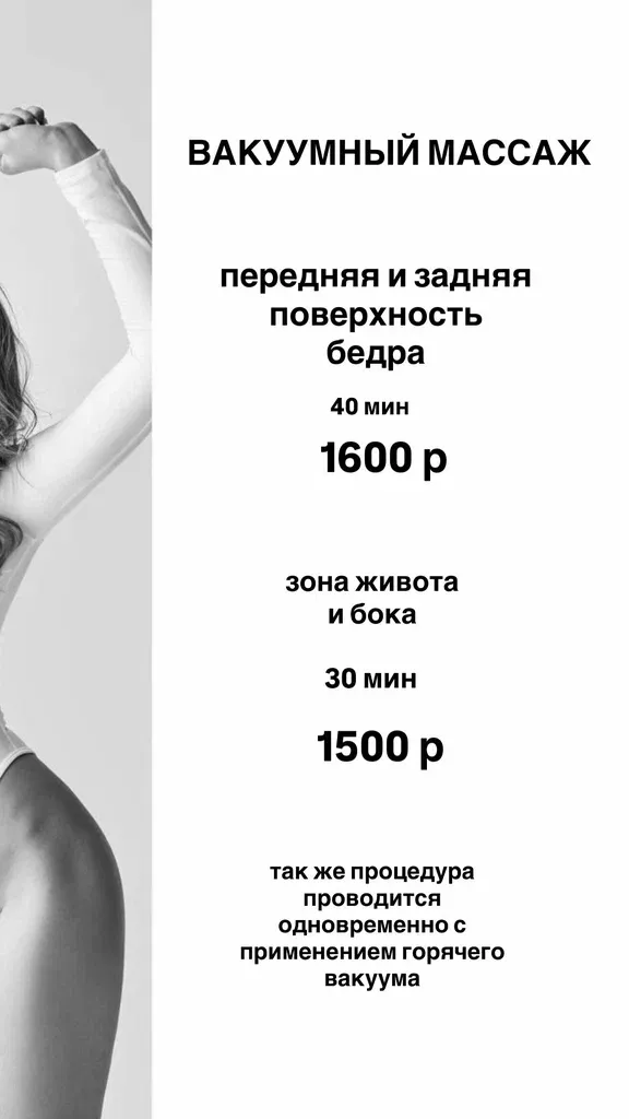Сфератела — фото 4