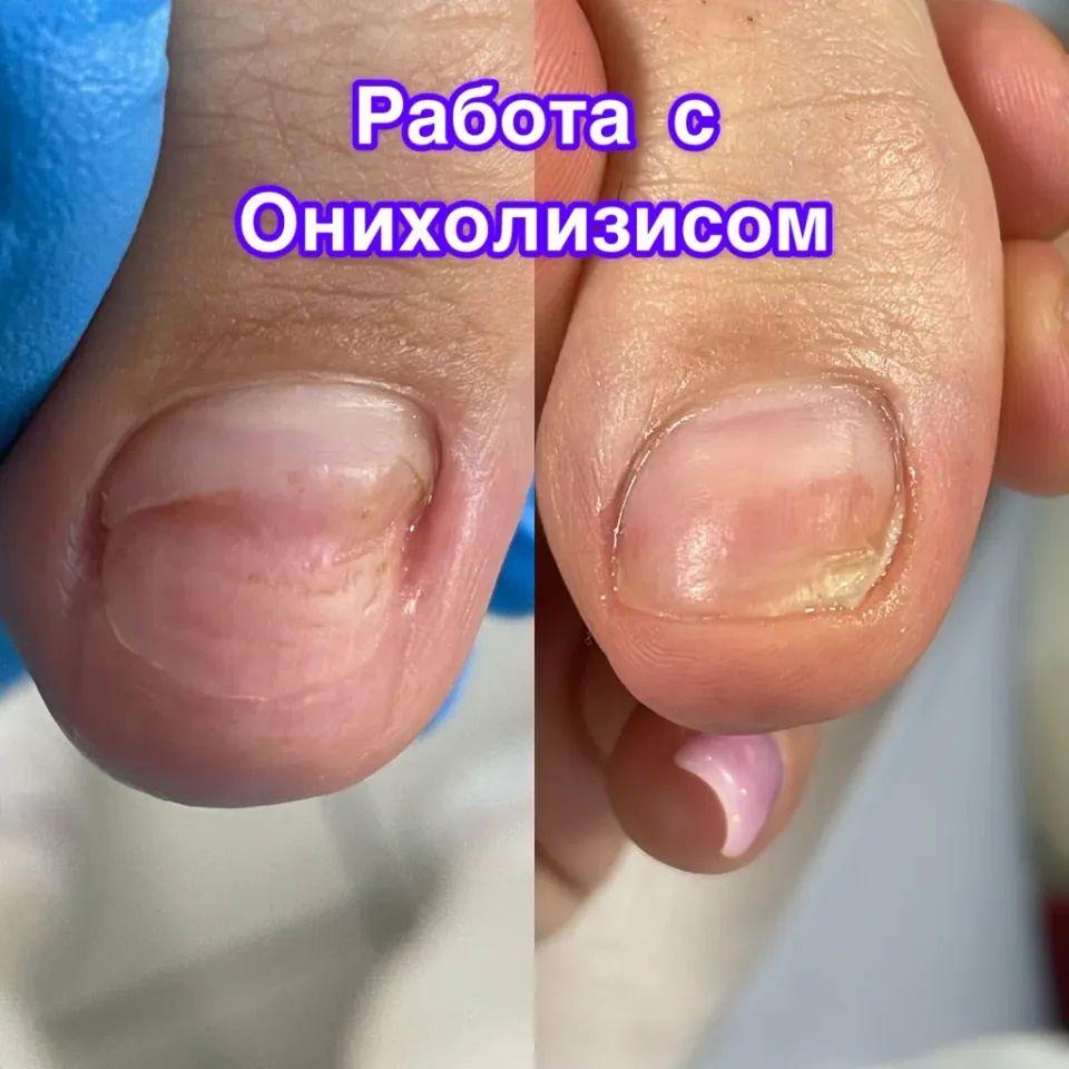Подолог Хромова К. С. — фото 3