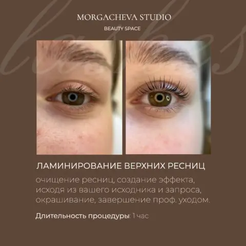Студия депиляции Светланы Моргачевой