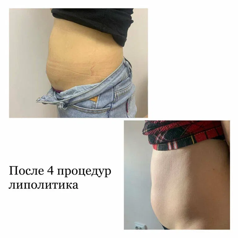 Кабинет косметолога Бахаревой Таисии — фото 3