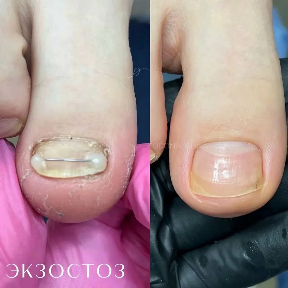 Кабинет педикюра и подологии — фото 3