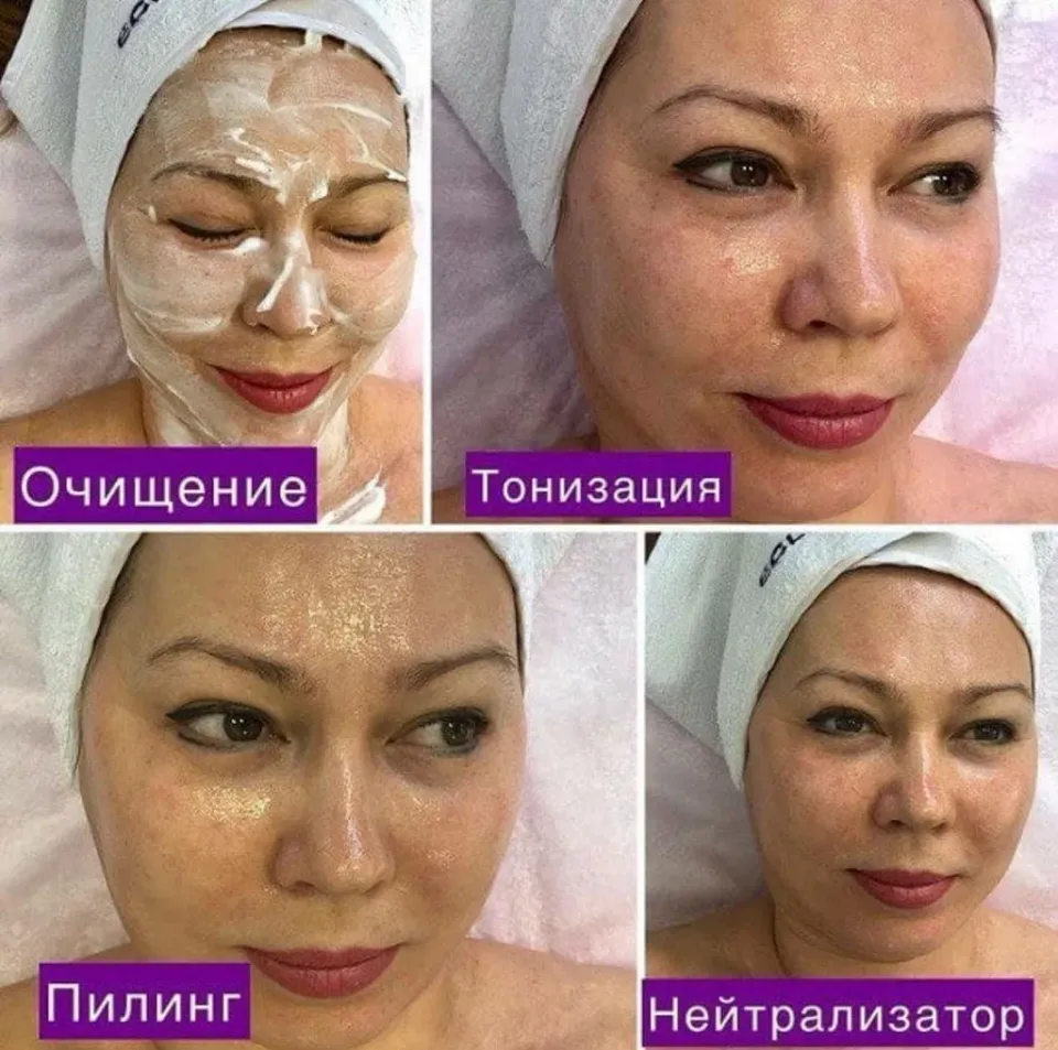 Косметолог Шевцова Н. С. — фото 5