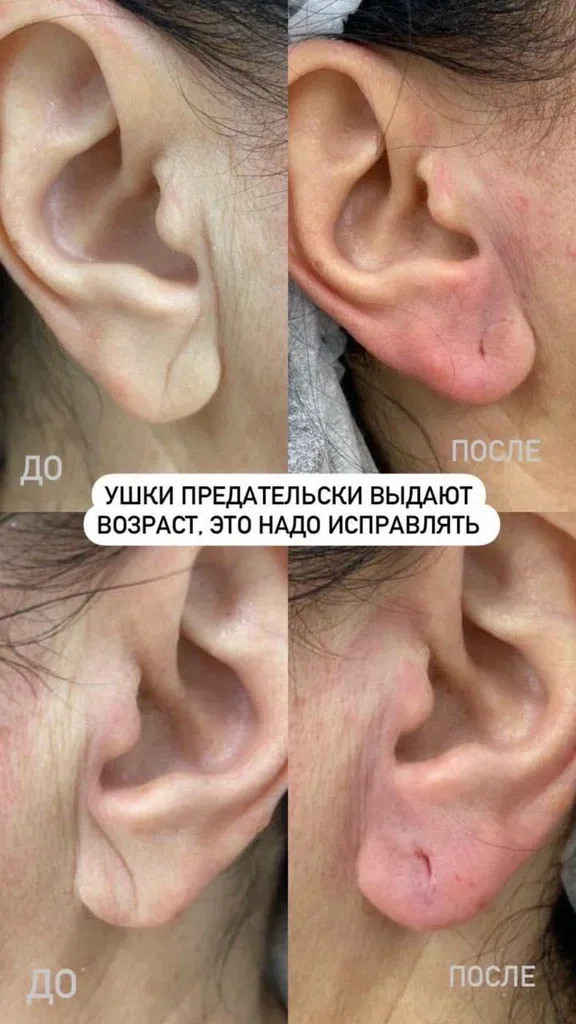 Косметолог-Пирсинг — фото 5