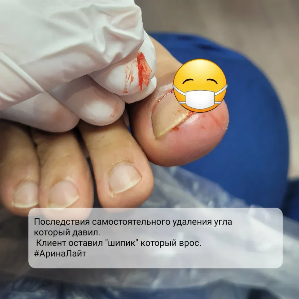 Подолог Арина Лайт Хамилонова — фото 3