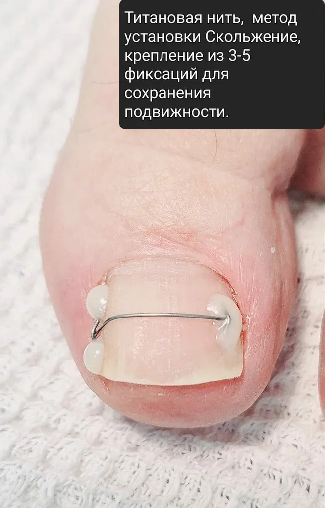 Подология — фото 3