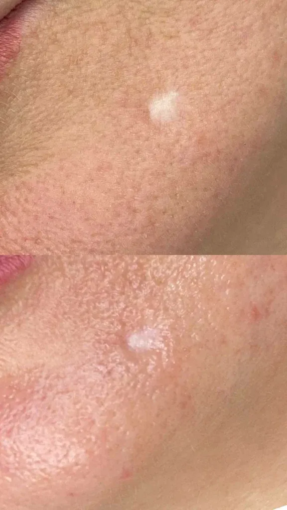 Студия чистой кожи My Clean Skin — фото 5