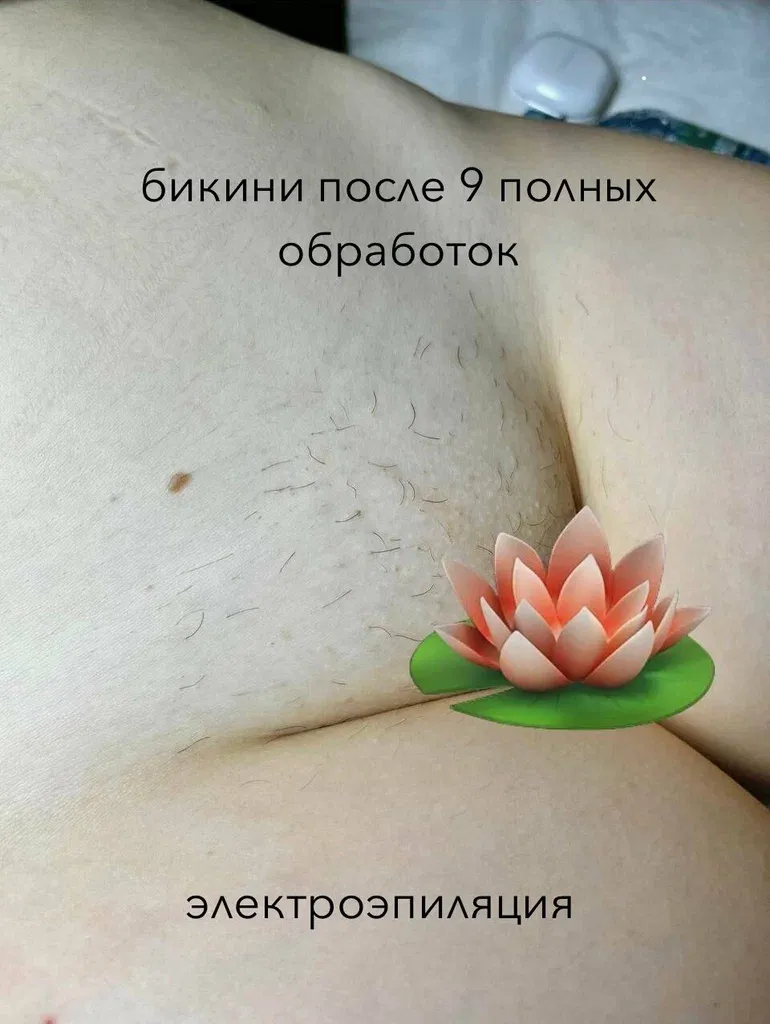 Студия электропиляции Антипиной Анны — фото 4