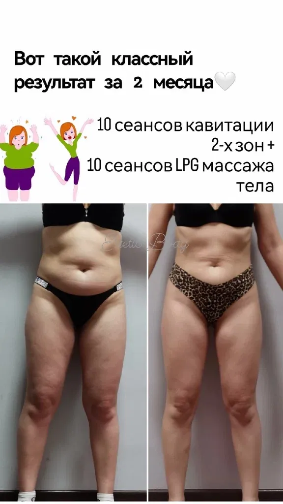 Estetics Body — фото 2