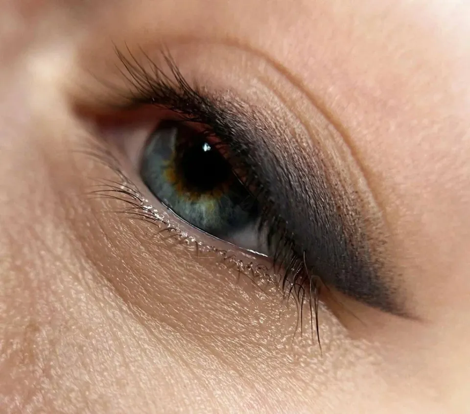 Grand Prix for Eyes — фото 3