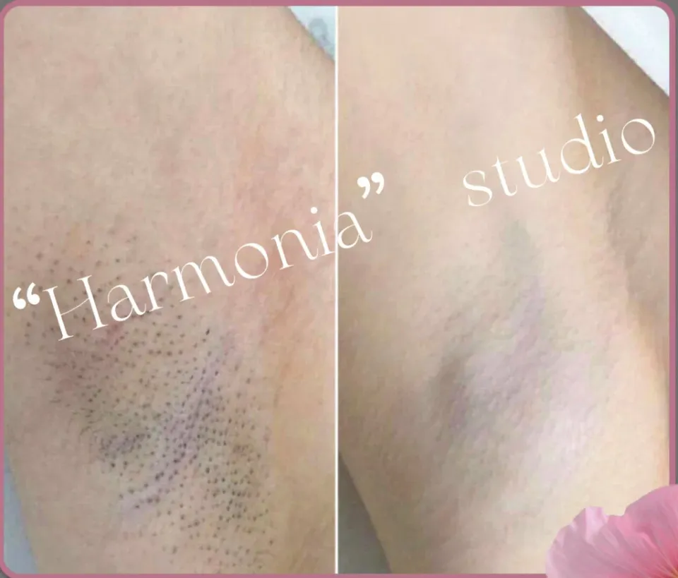 Harmonia — фото 6