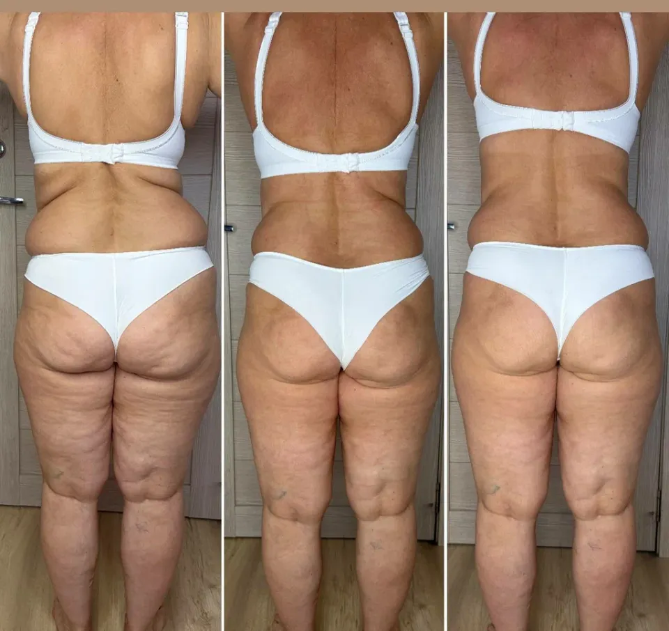 Slimbody — фото 4