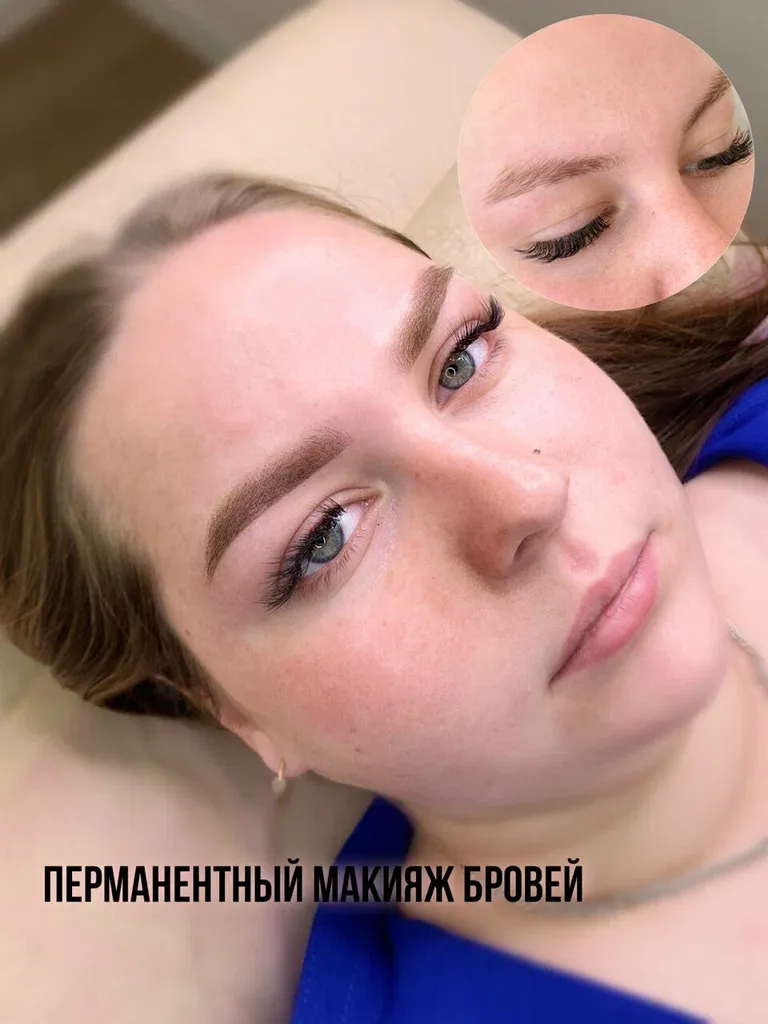 Top-brow — фото 4